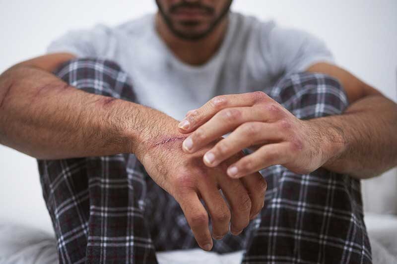 | Massachusetts Green Retail best cannabis strains for ptsd
